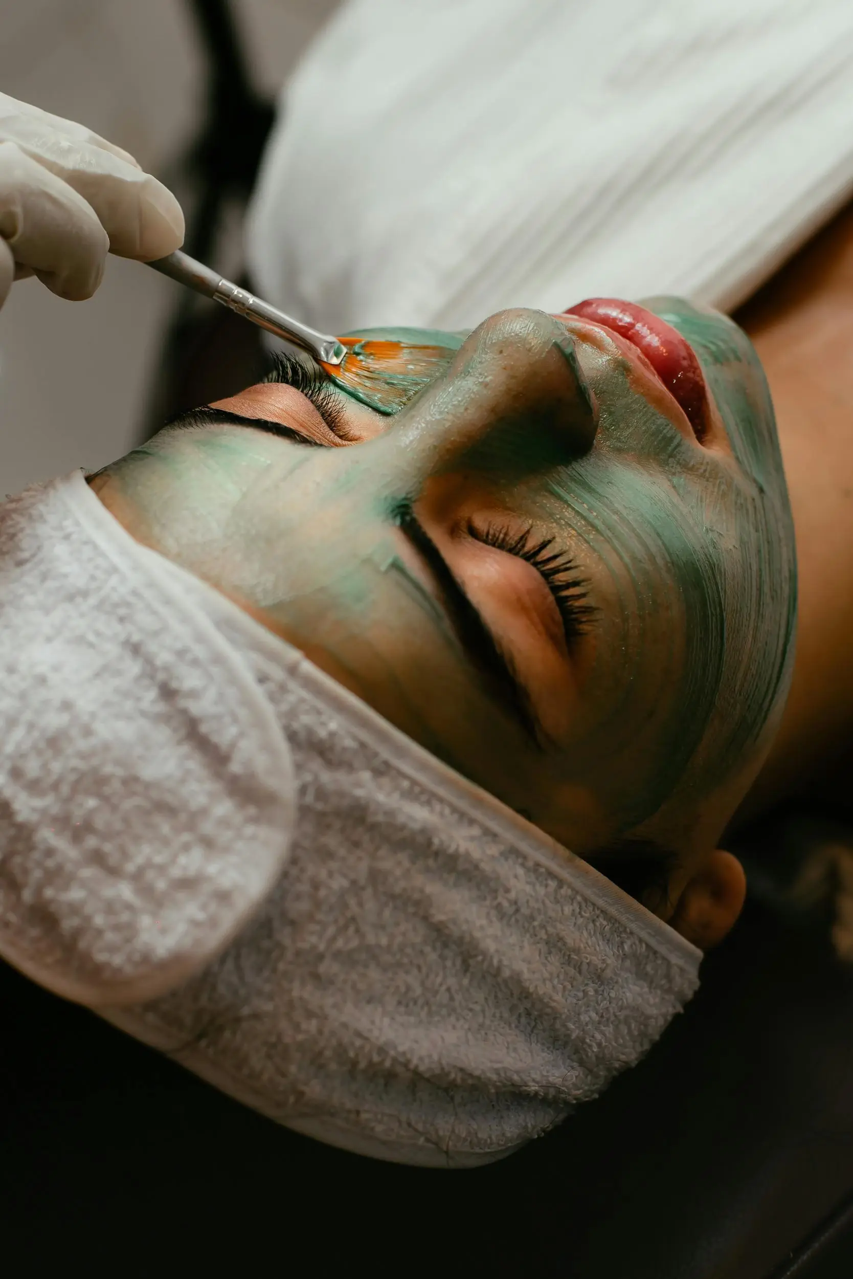 Biomicroneedling – Green-Sea-Peel-Behandlung