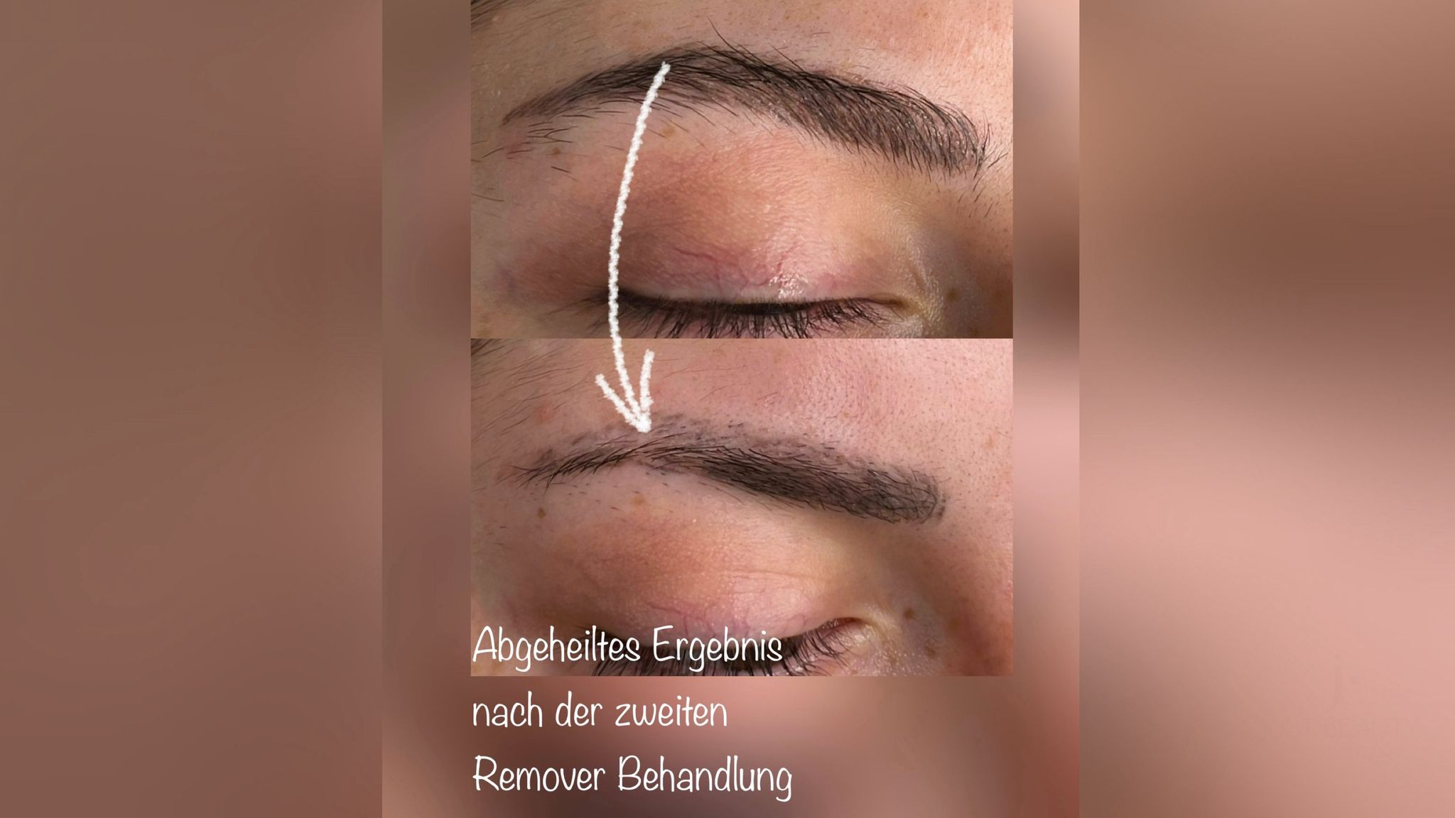 Beratungsgespräch – Entfernung Microblading / Permanent Make-up