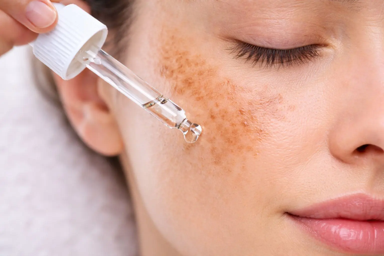 Laser-Peel-Behandlung